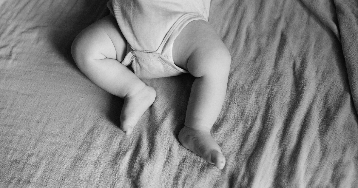 Synovial Sarcoma of the Parotid Gland in Infancy: A Rare Case Study