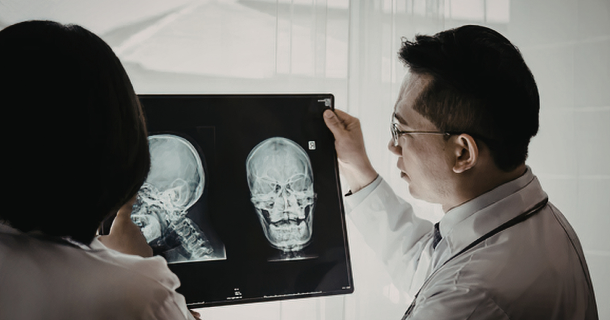 Rare Cranial Synovial Sarcoma Case Highlights Importance of Accurate Diagnosis